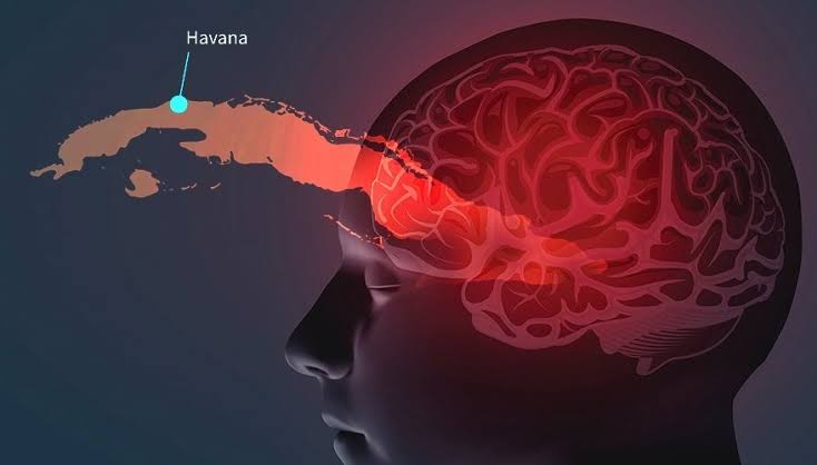 Havana Syndrome | New Ailment Linked To Russia 1 Havana syndrome